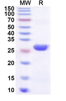 Human SMARCD3 Recombinant Protein (N-His)