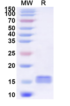 Recombinant Human SLC30A10 Protein, N-His