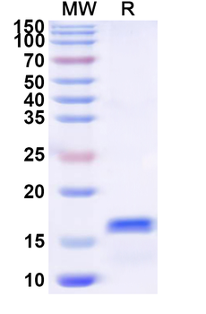 Human NKG2D/CD314 Recombinant Protein (N-His)