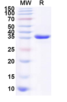 Human DTX2 Recombinant Protein (N-His)