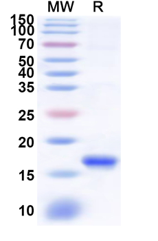 Recombinant Human KLRC3 Protein, N-His