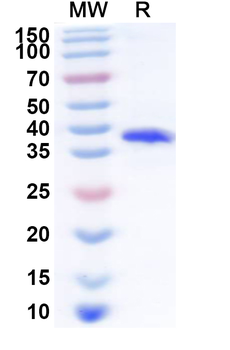 Human ZNF460 Recombinant Protein (N-His)