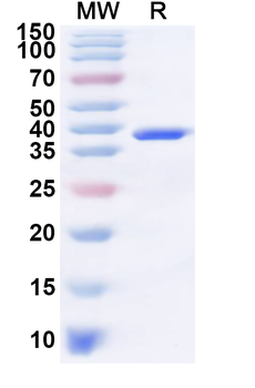 Recombinant Human RABAC1 Protein, N-GST & C-His