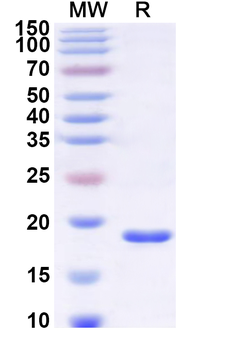 Recombinant Human SEC24A Protein, N-His