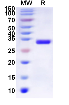 Recombinant Human GALR1 Protein, N-His-KSI