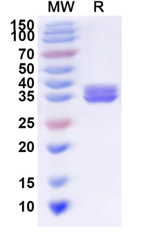 Recombinant Human TMEM108 Protein, N-His-KSI