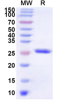 Recombinant Human GPER1 Protein, N-His-KSI