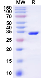 Recombinant Human SLC6A6 Protein, N-GST & C-His