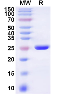 Human SLC13A3 Recombinant Protein (N-His-KSI)