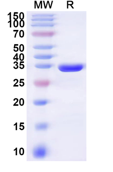 Recombinant Human FAIM2 Protein, N-His-KSI