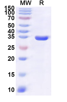 Recombinant Human SULT2A1 Protein, N-His
