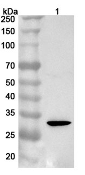 Human SULT2A1 Polyclonal Antibody
