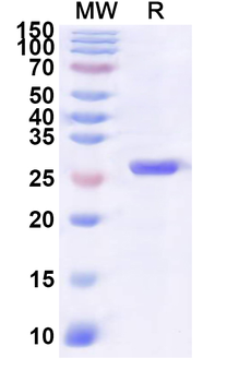 Human KANK1 Recombinant Protein (N-His)