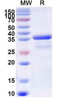 Human CARD18 Recombinant Protein (N-GST & C-His)