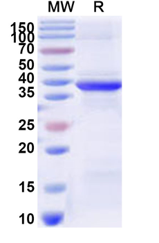 Recombinant Human RPS29 Protein, N-GST & C-His