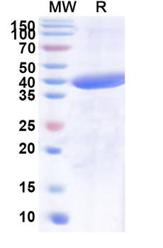 Recombinant Human SLC4A10 Protein, N-His