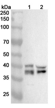 ADPRS Polyclonal Antibody
