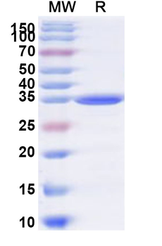 Recombinant Human BEND3 Protein, N-His
