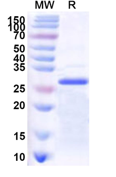 Human OXTR Recombinant Protein (N-His-KSI)