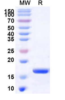 Human NCAPH2 Recombinant Protein (N-His)