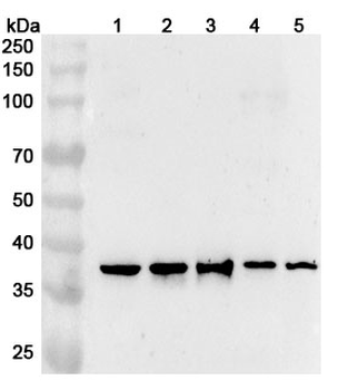 SRSF5 Polyclonal Antibody