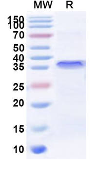 Human ZNF449 Recombinant Protein (N-His)
