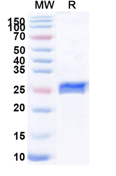 Recombinant Human NSMF Protein, N-His