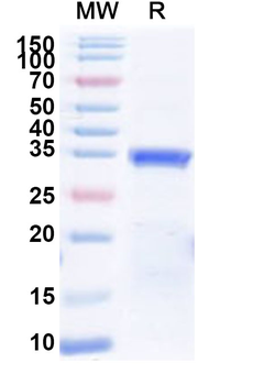 Recombinant Human PAX3 Protein, N-His