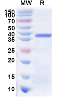 Recombinant Human ZNF322 Protein, N-His
