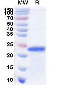 Recombinant Human RNF19B Protein, N-His
