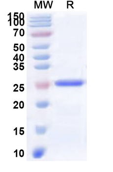 Human PACC1 Recombinant Protein (N-His)