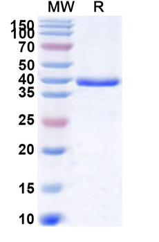 Recombinant Human MGAT2 Protein, N-His