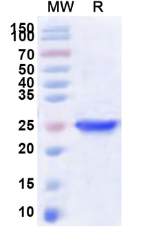 Human AVPR1B Recombinant Protein (N-His-KSI)