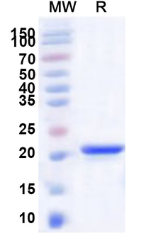 Recombinant Human NAA20 Protein, N-His