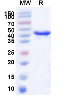 Recombinant Human PSMC5 Protein, N-His