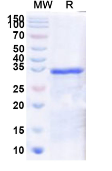 Human IRX4 Recombinant Protein (N-GST & C-His)