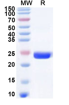 Human MEX3C Recombinant Protein (N-His)