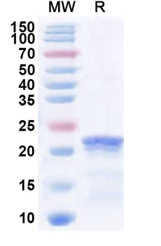 Recombinant Human COL19A1 Protein, N-His