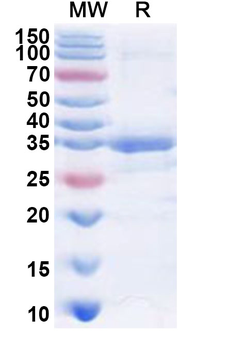 Human PHKG1 Recombinant Protein (N-His)