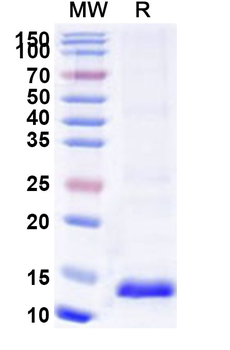 Recombinant Human ARPC5 Protein, N-His
