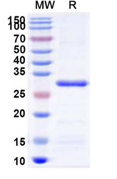 Recombinant Human HR Protein, N-His