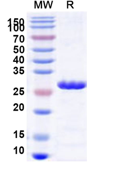 Human TBC1D4 Recombinant Protein (N-His)