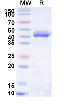 Recombinant Human CORO1C Protein, N-His