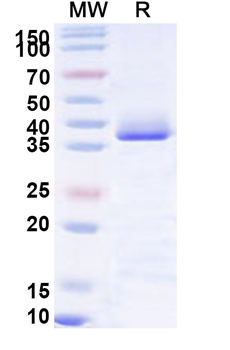 Human MARK1 Recombinant Protein (N-His)