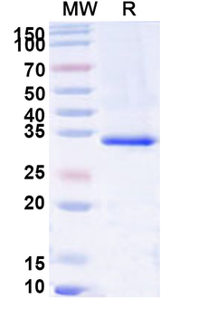 Recombinant Human ARL6 Protein, N-His