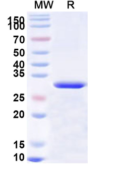 Recombinant Human NUAK2 Protein, N-His