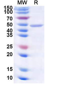 Recombinant VEEV Spike glycoprotein E1, N-His