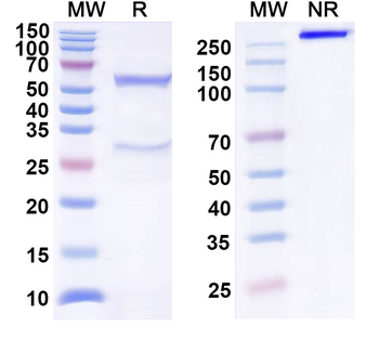 Human Mu-type opioid receptor/OPRM1/μOR Recombinant Antibody