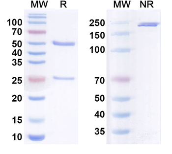 HCoV-HKU1 Spike RBD Antibody