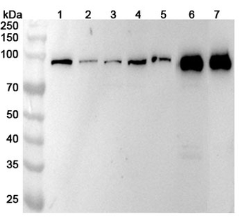ACO1 Polyclonal Antibody